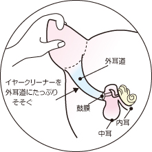 イヤークリーナー図